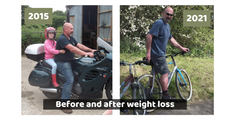 antes y después de la pérdida de peso